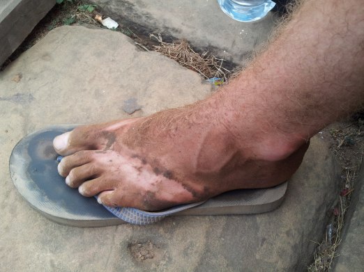 Angkor Feet